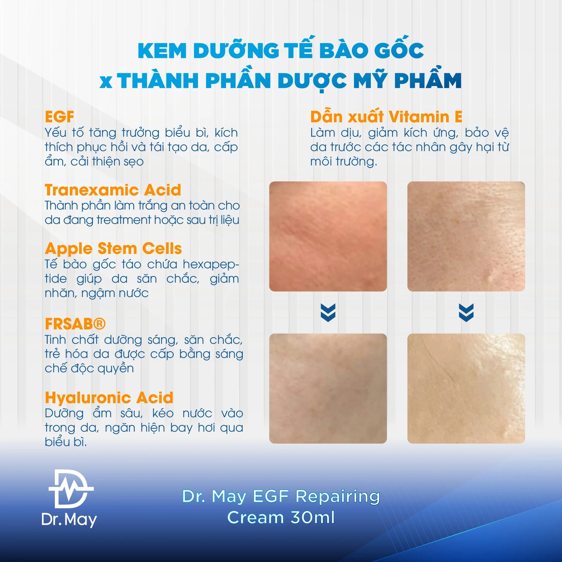 kem-duong-te-bao-goc-dr-may-3